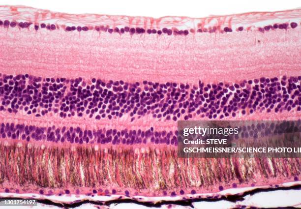 retina, lm - sensory nerve fibers stock pictures, royalty-free photos & images