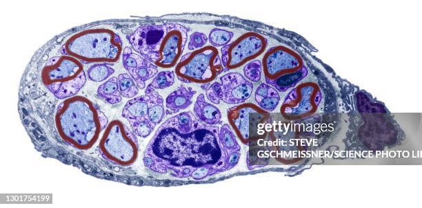 peripheral nerve, tem - endoneurium stock pictures, royalty-free photos & images