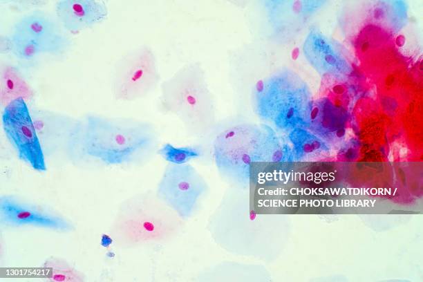 squamous epithelial cells, light micrograph - squamous epithelium stock pictures, royalty-free photos & images