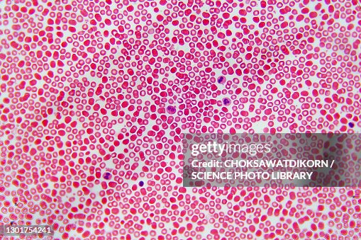 Blood cells, light micrograph Blood cells, light micrograph