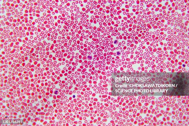 blood cells, light micrograph - hematology stock pictures, royalty-free photos & images