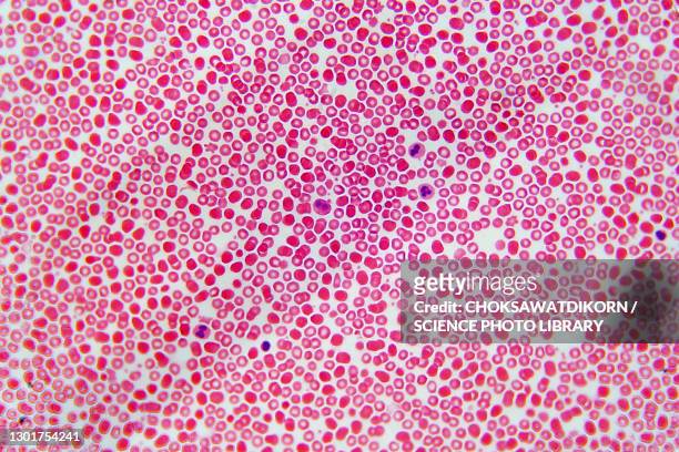 blood cells, light micrograph - hematology 個照片及圖片檔