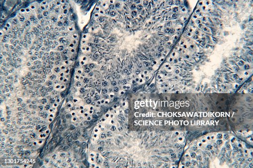 Human testis, light micrograph Human testis, light micrograph