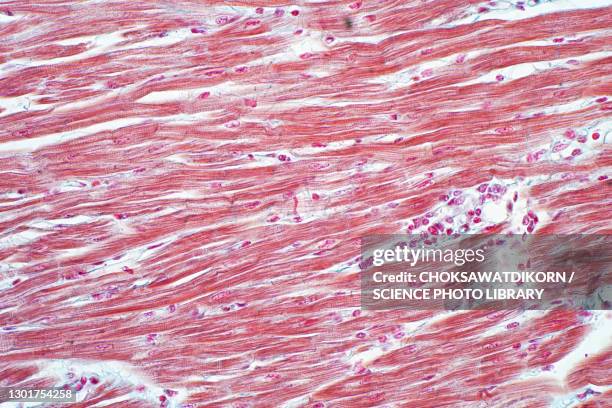 human cardiac muscle, light micrograph - myocardium stock-fotos und bilder