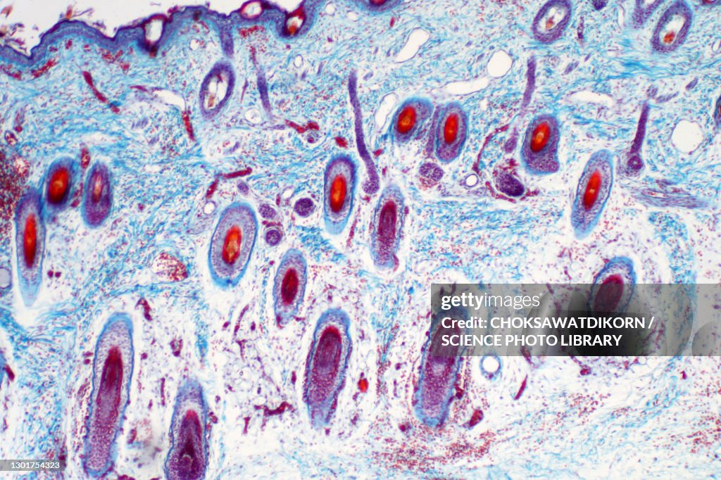 Human skin, light micrograph