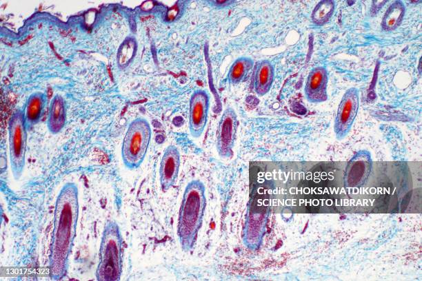 human skin, light micrograph - cross section of human skin stock pictures, royalty-free photos & images