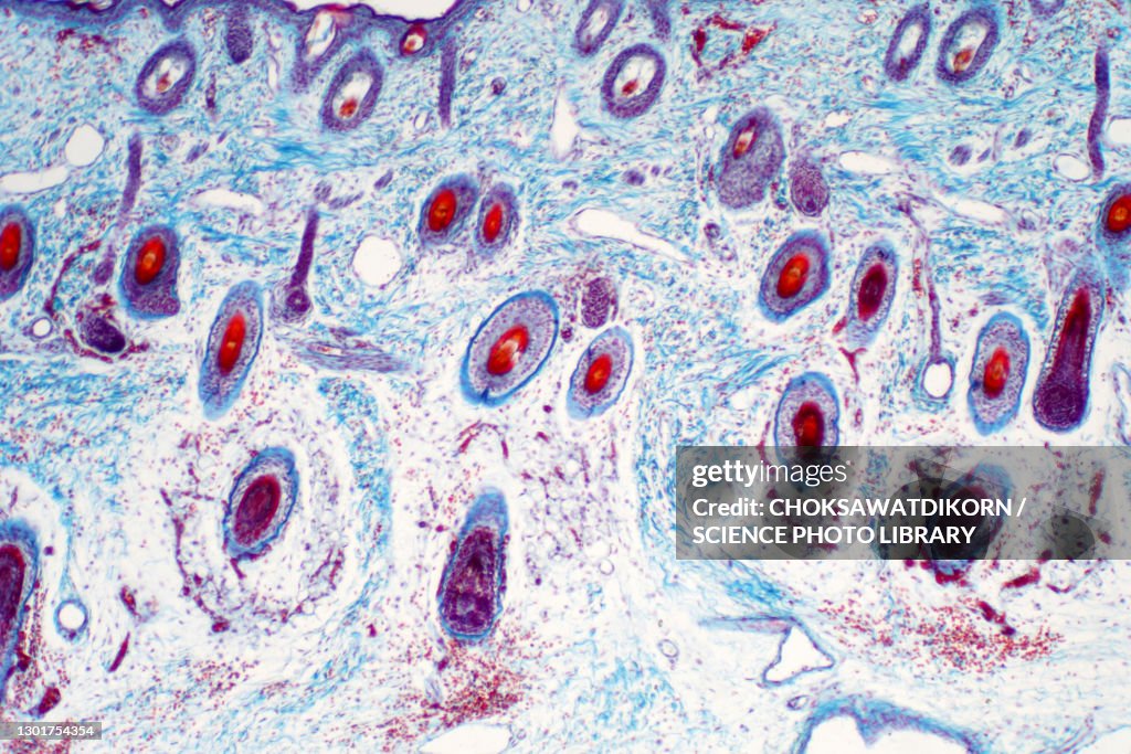 Human skin, light micrograph