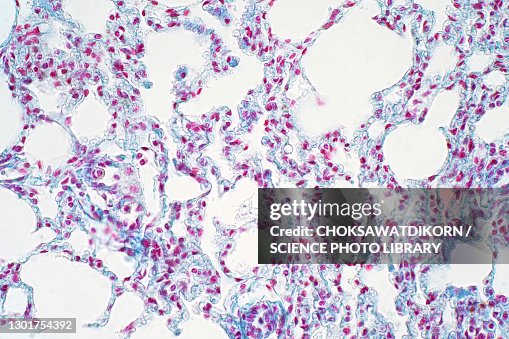 Human lung tissue, light micrograph Human lung tissue, light micrograph