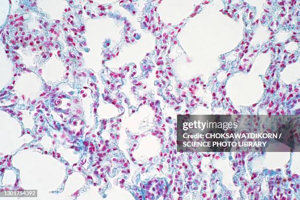 human lung tissue, light micrograph - histology 個照片及圖片檔