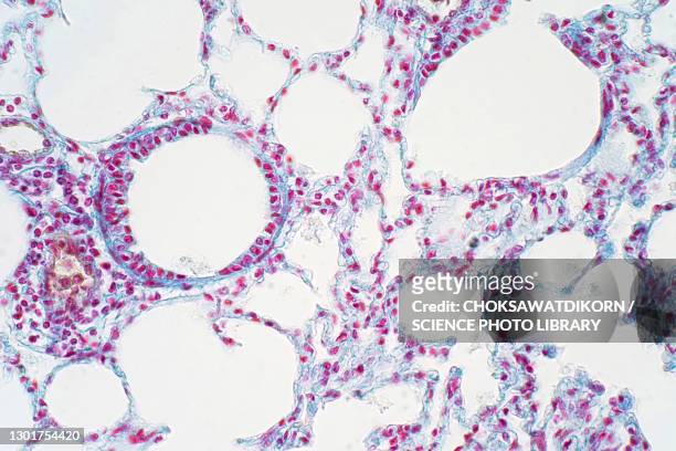 human lung tissue, light micrograph - light micrograph stock pictures, royalty-free photos & images