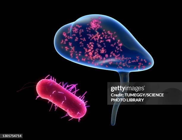 bacterial cystitis, illustration - bladder stock illustrations