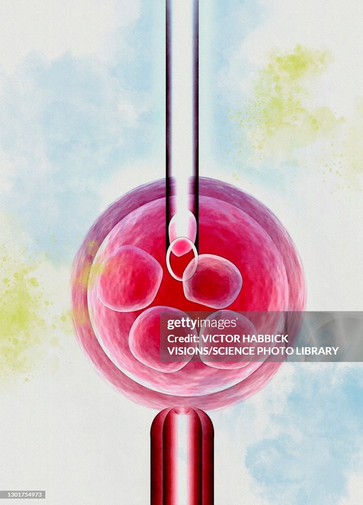 IVF, illustration