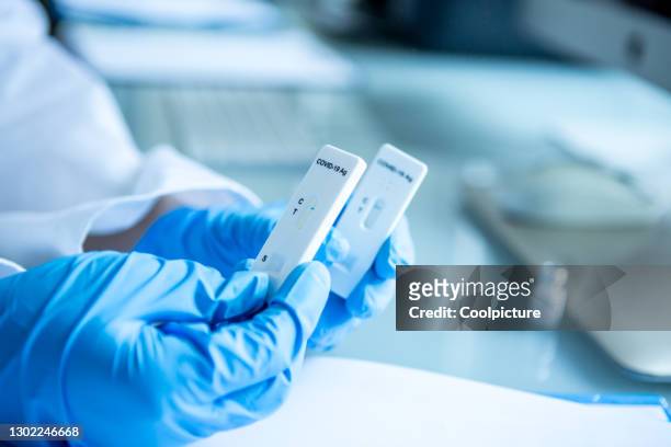 covid-19 diagnostic - antibody testing imagens e fotografias de stock