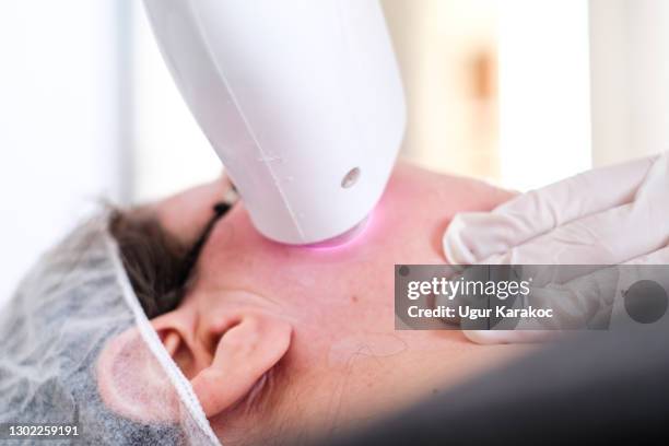 beautician giving epilation laser treatment on woman's face - láser fotografías e imágenes de stock