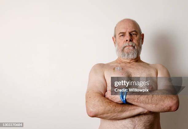 senior man cancer survivor after chemotherapy port removed - cancer patient portrait stock pictures, royalty-free photos & images