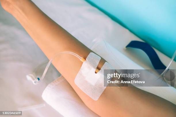 woman's hand with dropper set in hospital - vaso sanguigno foto e immagini stock