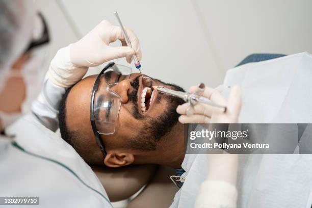 anesthesie - wortelkanaal stockfoto's en -beelden