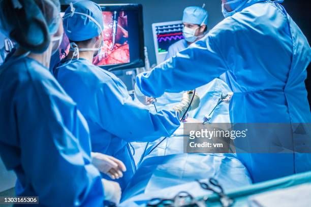 手術小組進行腹腔鏡手術 - laparoscopy 個照片及圖片檔