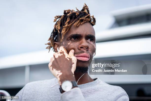 young african-american man with vitiligo skin disorder, melanocyte, loss of melanin - vitiligo stock pictures, royalty-free photos & images