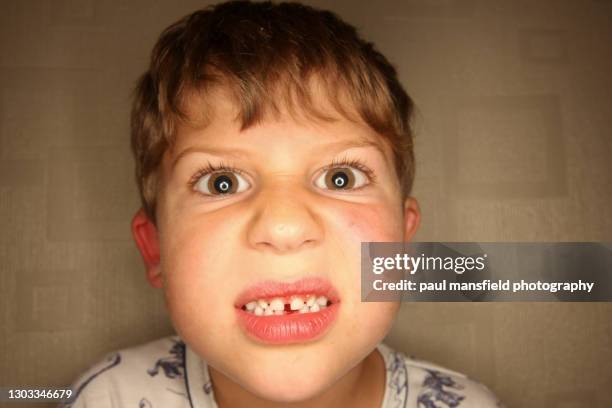 close up of boy with missing tooth - sarcastic faces stock pictures, royalty-free photos & images