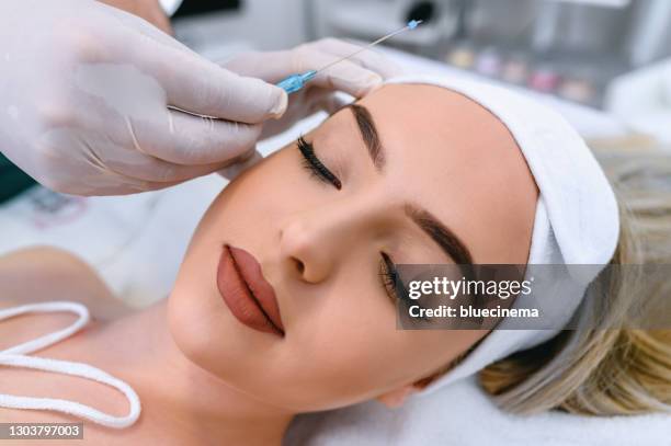 mesotherapy facelifting procedure - thread stock-fotos und bilder