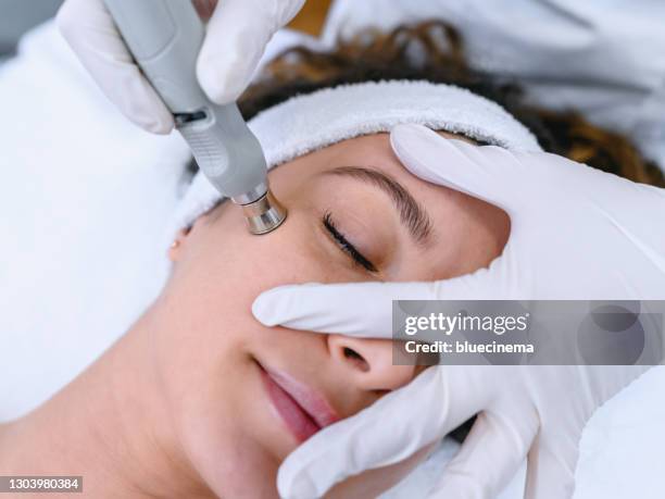 gesichtsbehandlung - laser stock-fotos und bilder
