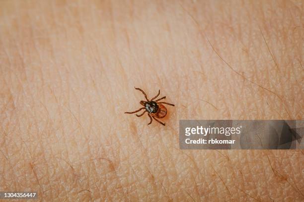 scary insect taiga mite crawling on human skin close up - lymeziekte stockfoto's en -beelden