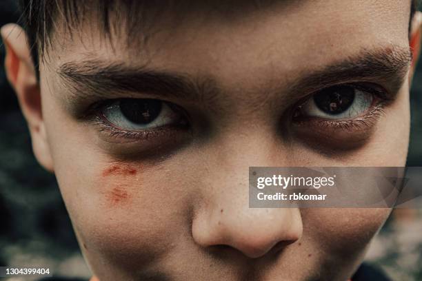 a close-up of the face of a serious scarred boy looking up with resentment with angry eyes. teenage conflict or battered child. domestic violence - olho preto - fotografias e filmes do acervo