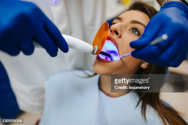 using dental curing light equipment at dentistry office - canal da raiz imagens e fotografias de stock