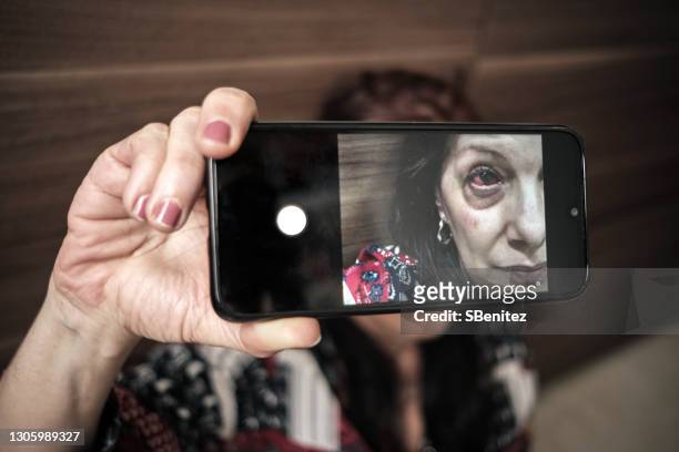 a woman has a red eye - cornea stock pictures, royalty-free photos & images