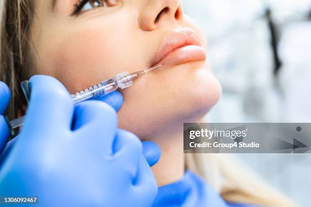 facial aesthetics surgery treatment - ha stock pictures, royalty-free photos & images