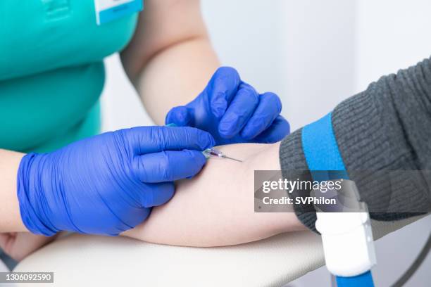 the nurse takes the venous blood from the patient's hand. - tourniquet stock pictures, royalty-free photos & images