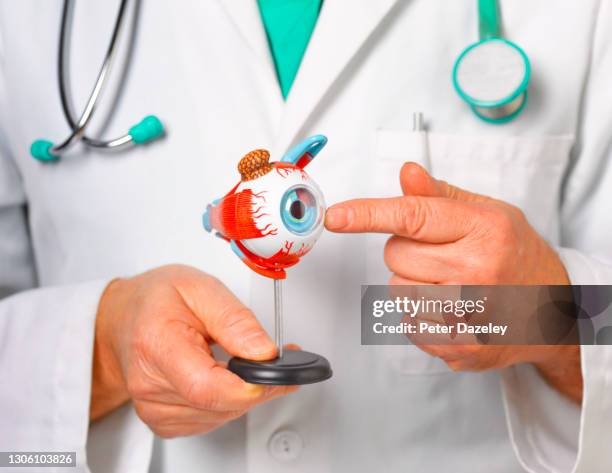 surgeon with model of the human eye - cataract eye stock pictures, royalty-free photos & images