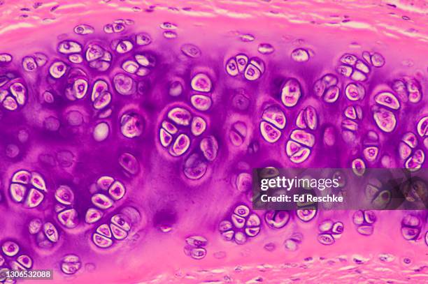 hyaline cartilage--cartilage cells (chondrocytes), lacunae, matrix, perichondrium, 100x - hyalien kraakbeen stockfoto's en -beelden