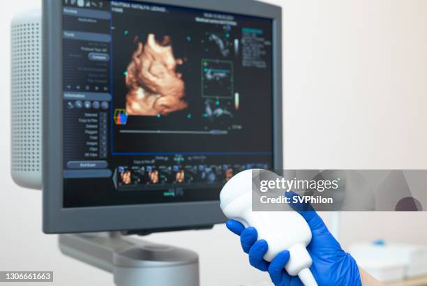 mano del médico con un escáner de ultrasonido en el fondo del monitor. - ecografía fotografías e imágenes de stock