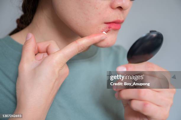 woman looking her face by mini mirror before applying an antiviral cream or ointment to treat herpes labialis on her lower lip. - cream mouth stock-fotos und bilder