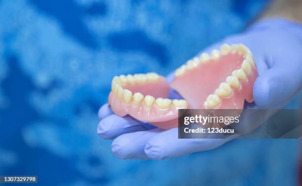 dentista sosteniendo prótesis - denture fotografías e imágenes de stock