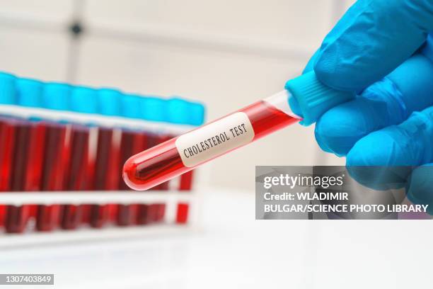 cholesterol blood test, conceptual image - cholesterin stock-fotos und bilder