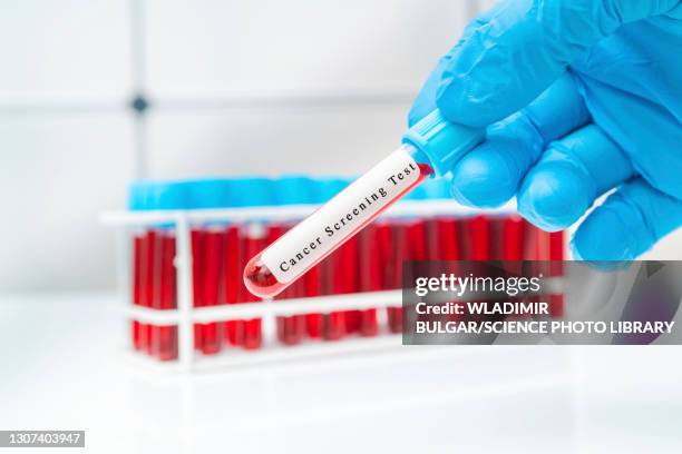 colon cancer blood test, conceptual image - bluttest stock-fotos und bilder