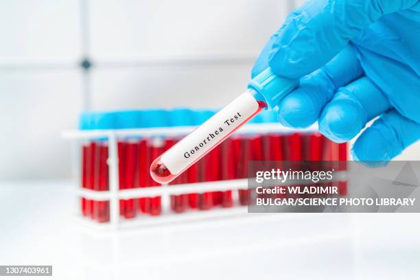 gonorrhea blood test, conceptual image - gonorrhea bacterium stock pictures, royalty-free photos & images