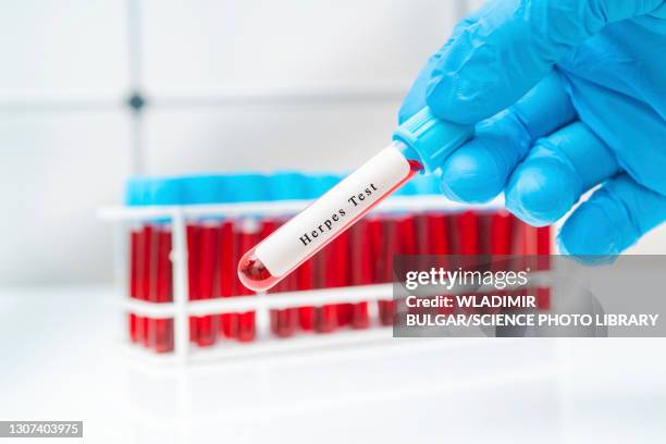 herpes blood test, conceptual image - herpes stock pictures, royalty-free photos & images