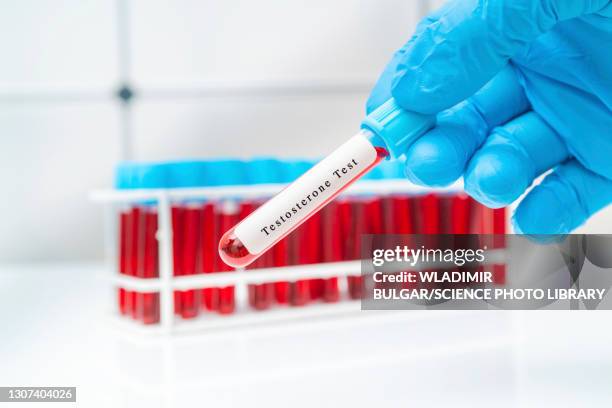 testosterone blood test, conceptual image - testosterone stock pictures, royalty-free photos & images