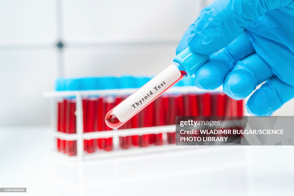 Thyroid blood test, conceptual image