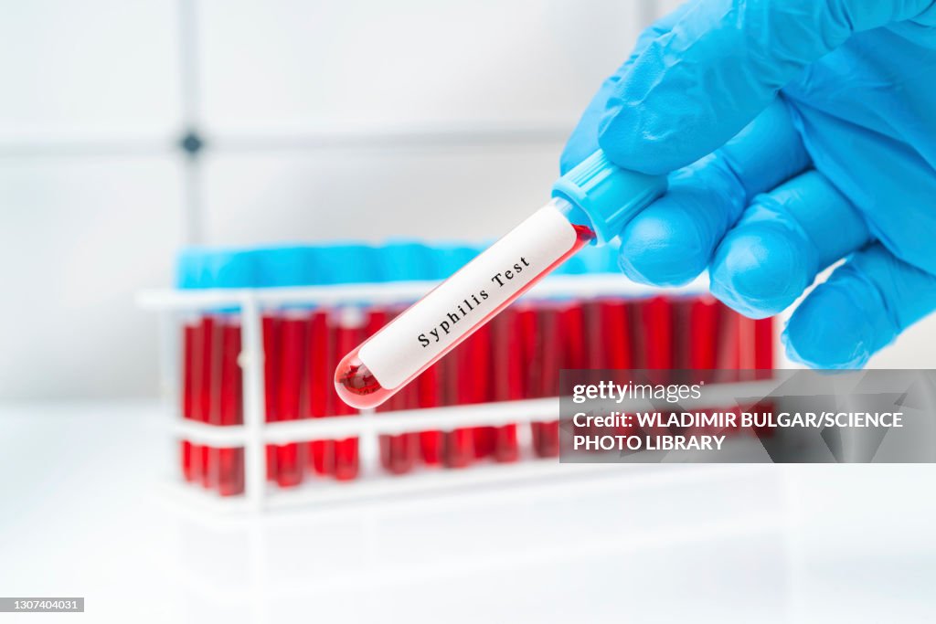 Syphilis blood test, conceptual image
