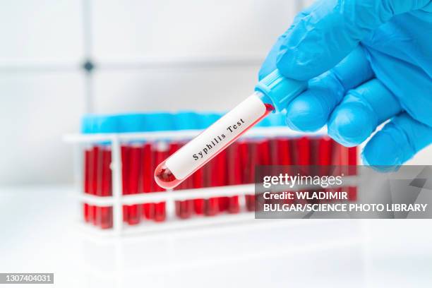 syphilis blood test, conceptual image - treponema pallidum imagens e fotografias de stock