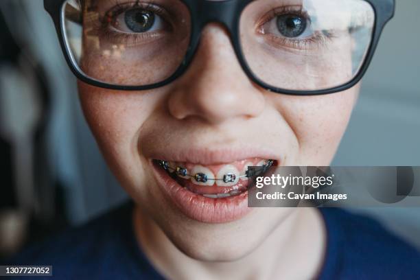 close up of young teen boy with glasses and braces - laughing teen stockfoto's en -beelden