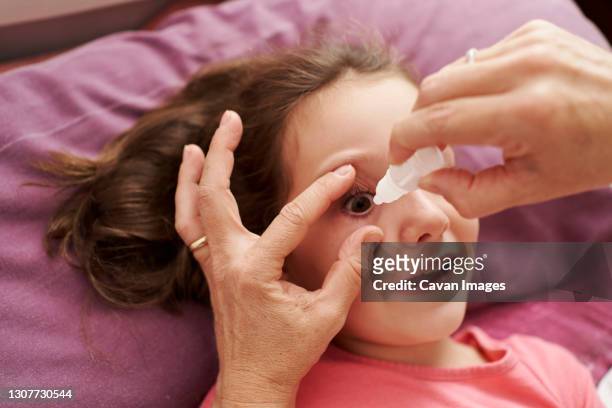 detail of female doctor smiling and giving eye drops to a little girl in her bed. home doctor concept - eye problems stock pictures, royalty-free photos & images