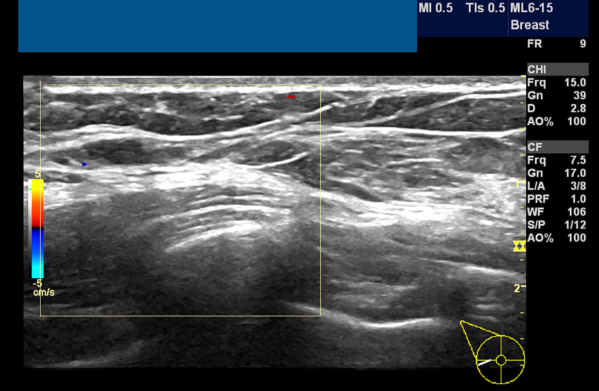 high resolution imaging