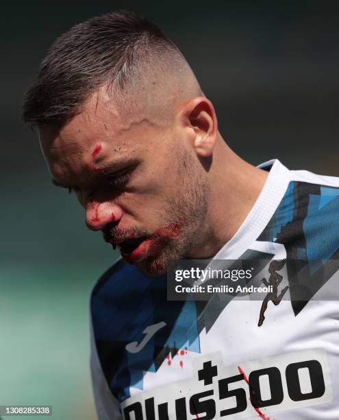 Rafael Toloi of Atalanta BC looks on after picking up a face injury during the Serie A match between Hellas Verona FC and Atalanta BC at Stadio...