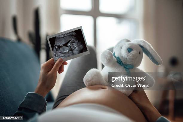 pregnant woman expecting a new life - pregnancy scan stock pictures, royalty-free photos & images